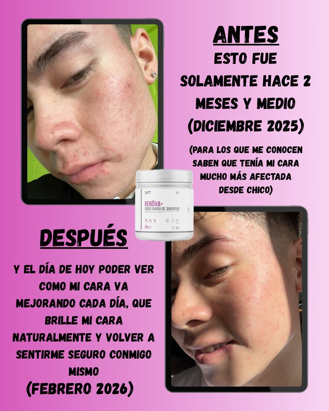 Testimonio antes y después piel